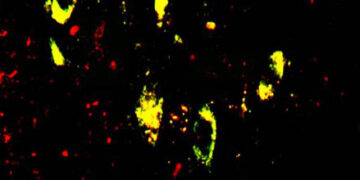 El Centro de Investigación del Cáncer de Salamanca desarrolla una herramienta informática para analizar las alteraciones genéticas del genoma de las células cancerosas