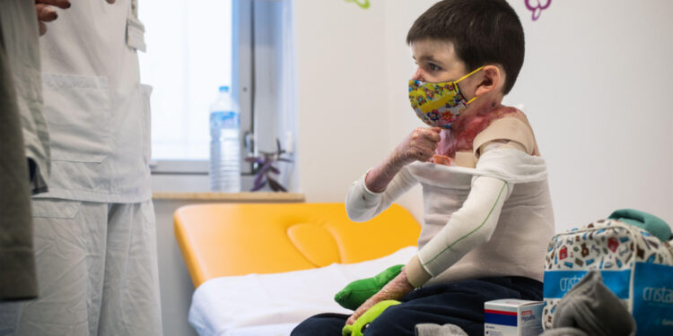 Los afectados por la enfermedad ‘rara’ Piel de Mariposa reclaman más ayudas a las administraciones