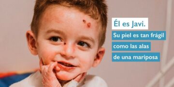 El IV Mercado Medieval de Castellanos contará con una treintena de puestos y uno solidario a favor de la Asociación Debra-Piel de Mariposa